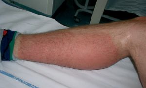 El simetrio de venas rojas, un simetrio mediterráneo